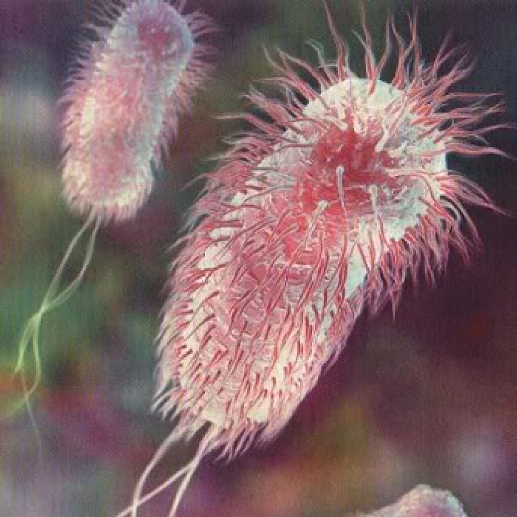 E coli вызывает. Кишечная палочка описание. Кишечная палочка эшерихиоз. Кишечная палочка возбудитель пищевых токсикоинфекций. Кишечная палочка токсикоинфекция.