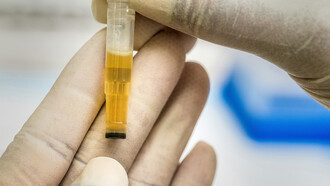 La recolección de orina en barrios del conurbano expone una trama poco visible donde lo cotidiano, lo legal y lo farmacéutico se cruzan en silencio