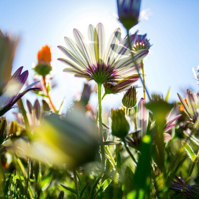 La diagnosi è prevalentemente clinica e si basa sull’esclusione di altre patologie reumatiche o neurologiche