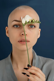 A woman with cancer holding flowers in her hand
