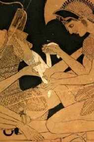 L'arte medica nell'Antica Grecia