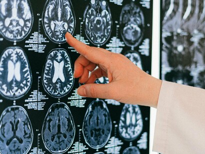 Os autores do estudo também criaram imagens comparativas entre fatias do córtex cerebral e seções da simulação do universo. Visualmente, as semelhanças são impressionantes: redes finas ligando pontos brilhantes, com espaçamentos regulares e padrões de ramificação semelhantes

