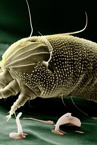 Dust mite enlarged under the microscope