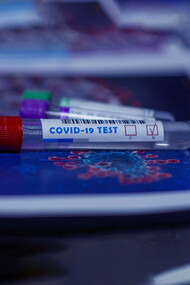 Da oltre 9 mesi SARS-CoV-2 ha corrisposto alle due definizioni base di pandemia 