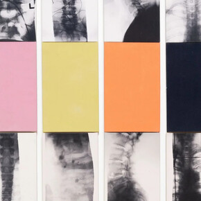 Kunié Sugiura, Vertebra (detail), 2021. Courtesy of Moskowitz Bayse