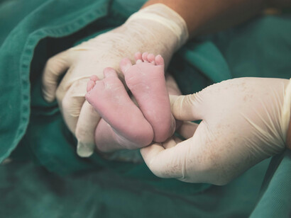 A midwife gently supports the newborn’s tiny legs