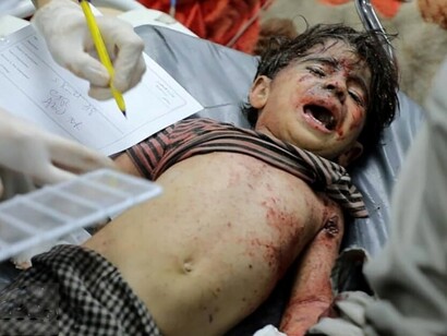 Gli attacchi di Israele si sono intensificati dopo il 7 ottobre 2023. Nella foto un bambino colpito durante un raid aereo sulla Striscia di Gaza. Foto di Ghassan Salem
