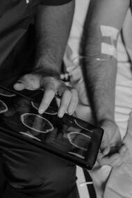 Malattia. Dottore illustra stato di avanzamento di un tumore al paziente