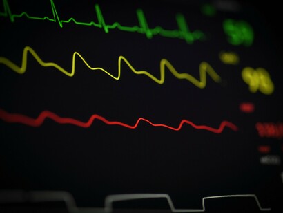 Resting heart rate patterns can reveal early warning signs long before symptoms appear