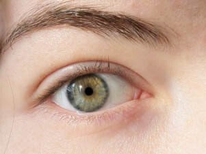 Un cirujano puede crear una vía lacrimal nueva mediante un abordaje transconjuntival, lo que significa que se accede sin necesidad de hacer una incisión externa