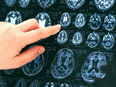 A proposta do estudo era ambiciosa: comparar a estrutura do cérebro humano, especificamente o córtex cerebelar e a rede neuronal, com a estrutura em grande escala do universo. Os pesquisadores usaram simulações computacionais de ponta do cosmos e imagens microscópicas do cérebro humano. Eles analisaram a densidade, complexidade, número de conexões e distribuição de matéria dos dois sistemas