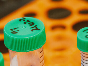 Humanity's always been threatened by dangerous diseases. Science and technology help us win the war against many viruses