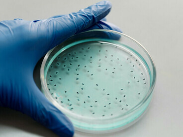 Los biomarcadores pronósticos ayudan a predecir la evolución clínica de un paciente y a anticipar posibles complicaciones