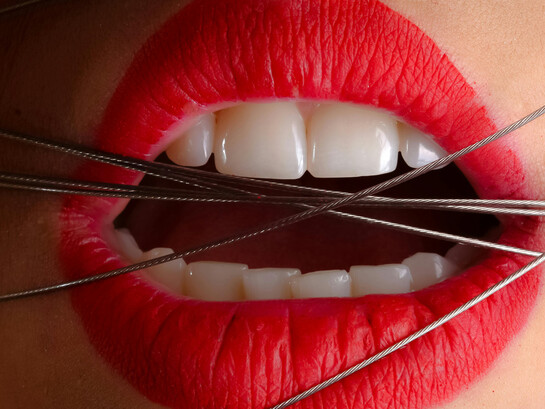 A close-up photo of a woman wearing red lipstick with gray cables across her mouth