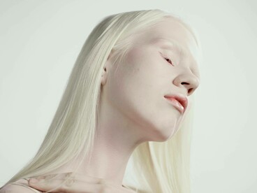 Donna con albinismo. L'autrice si è confrontata con l'associazione Albinit per restituire autenticità e rispetto al personaggio di Aria, nata dall'incontro con persone albine