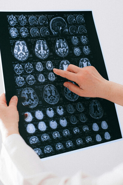 A medical expert reviewing a brain MRI scan while indicating specific areas