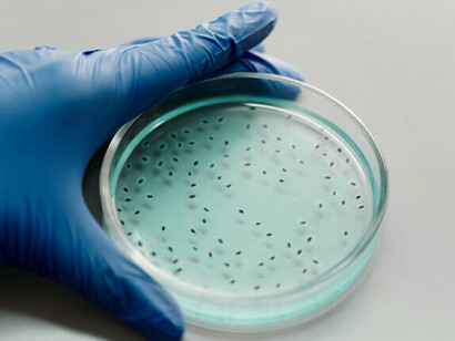 Los biomarcadores pronósticos ayudan a predecir la evolución clínica de un paciente y a anticipar posibles complicaciones