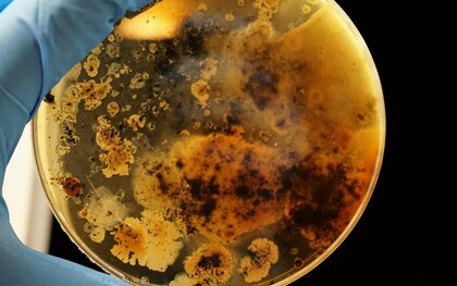 Une boite de Pétri est une boite transparente dans laquelle on coule de l'agar, matière gélatineuse neutre, additionnée des diverses substances dont on veut tester l'effet, dont des nutriments. Ce milieu permet de cultiver des bactéries ou des micro-champignons